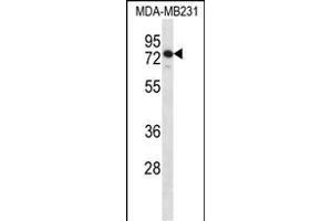 SLFN12 Antibody (Center) (ABIN1538019 and ABIN2849329) western blot analysis in MDA-M cell line lysates (35 μg/lane). (SLFN12 anticorps  (AA 192-220))