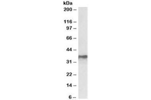 Western blot testing of MCF7 lysate with HNRNPA2B1 antibody at 0. (HNRNPA2B1 anticorps)