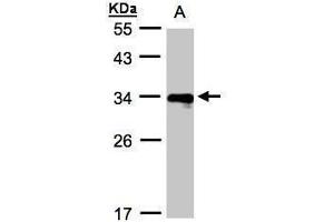 WB Image Sample(30 ug whole cell lysate) A:Raji , 12% SDS PAGE antibody diluted at 1:1000