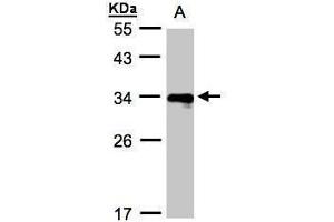 WB Image Sample(30 ug whole cell lysate) A:Raji , 12% SDS PAGE antibody diluted at 1:1000 (HLA-DRB4 anticorps  (Center))