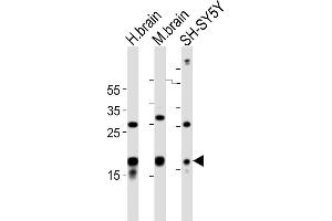All lanes : Anti-STMN2 Antibody (Center) at 1:1000 dilution Lane 1: human brain lysates Lane 2: mouse brain lysates Lane 3: SH-SY5Y whole cell lysates Lysates/proteins at 20 μg per lane. (STMN2 anticorps  (AA 82-116))