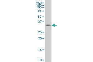 WDR5 polyclonal antibody (A01), Lot # FAK0060414QCS1 Western Blot analysis of WDR5 expression in A-549 .