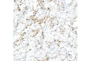 Immunohistochemistry (IHC) image for anti-CD16 (CD16) (AA 21-201) antibody (ABIN7449423) (Recombinant CD16 anticorps  (AA 21-201))