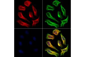 ABIN6264995 and ABIN6273073 staining Hela cells by IF/ICC.