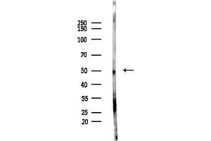 anti-Interferon Regulatory Factor 3 (IRF3) (pSer386) antibody