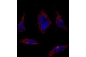 Image no. 4 for anti-SRY (Sex Determining Region Y)-Box 2 (SOX2) (N-Term) antibody (ABIN357437)