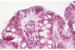 Image no. 1 for anti-EPH Receptor B3 (EPHB3) (AA 552-601) antibody (ABIN6749784)