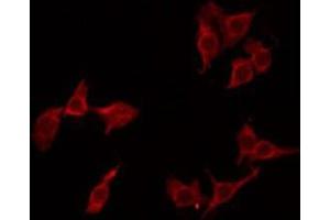 ABIN6275259 staining LOVO by IF/ICC. (MNDA anticorps  (Internal Region))