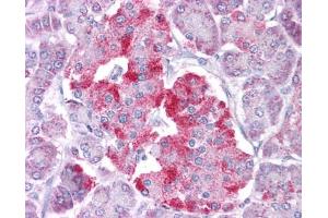 Immunohistochemistry (IHC) image for anti-Signal Transducer and Activator of Transcription 1, 91kDa (STAT1) (N-Term) antibody (ABIN2780843)