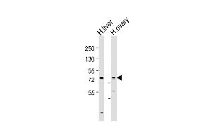 Western Blot at 1:2000 dilution Lane 1: human liver lysates Lane 2: human ovary lysates Lysates/proteins at 20 ug per lane.