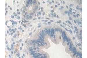 Detection of CPB1 in Mouse Uterus Tissue using Polyclonal Antibody to Carboxypeptidase B1, Tissue (CPB1) (CPB1 anticorps  (AA 109-415))