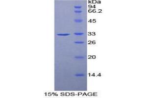 SDS-PAGE (SDS) image for Ribonuclease/angiogenin Inhibitor 1 (RNH1) (AA 76-333) protein (His tag) (ABIN2126693) (RNH1 Protein (AA 76-333) (His tag))