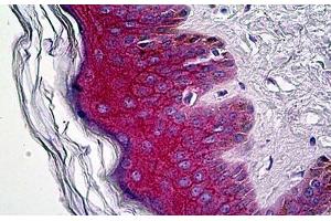 Anti-Gamma Catenin antibody IHC staining of human skin. (JUP anticorps  (C-Term))