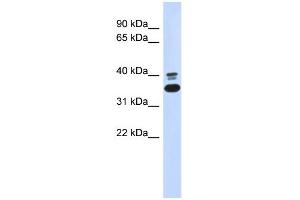 WB Suggested Anti-ABHD7 Antibody Titration: 0. (EPHX4 anticorps  (N-Term))