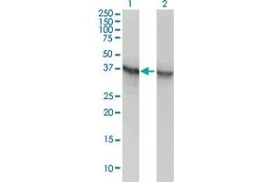 Western Blot analysis of ALDOA expression in transfected 293T cell line by ALDOA monoclonal antibody (M02), clone 3C12-6D11.