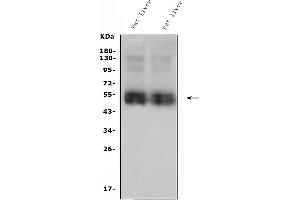 Western blot analysis of SLC10A1/NTCP1 using anti-SLC10A1/NTCP1antibody (ABIN7602754).