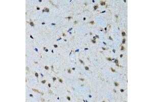 Immunohistochemistry of paraffin-embedded rat brain using IGF1 antibody. (IGF1 anticorps  (C-Term))