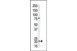 The anti-CDKN1A Pab (ABIN391763 and ABIN2841628) is used in Western blot to detect CDKN1A in T-47D cell lysate.