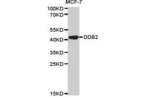 Western Blotting (WB) image for anti-Damage-Specific DNA Binding Protein 2, 48kDa (DDB2) antibody (ABIN1872225) (DDB2 anticorps)