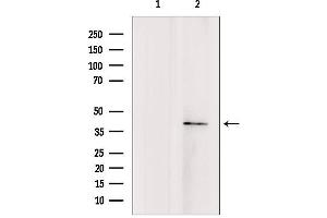 Western blot analysis of extracts from rat brain, using TMOD4 antibody.