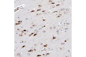 Immunohistochemical staining (Formalin-fixed paraffin-embedded sections) of human cerebral cortex with RRAGB polyclonal antibody  shows strong cytoplasmic positivity in neuronal cells.