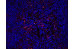 Immunofluorescence analysis of Mouse inflammatory spleen using ITGAX Polyclonal Antibody at dilution of 1:200.