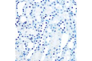 Immunohistochemistry of paraffin-embedded mouse kidney using M/M/ML1 Rabbit mAb (ABIN7268354) at dilution of 1:100 (40x lens). (MAD2L1 anticorps)