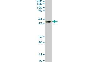 SMAD7 monoclonal antibody (M06), clone 4E1. (SMAD7 anticorps  (AA 160-260))