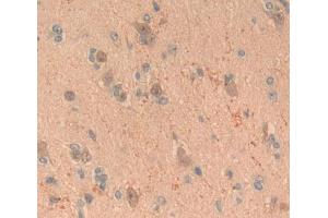 Used in DAB staining on fromalin fixed paraffin- embedded brain tissue (FGF20 anticorps  (AA 1-211))