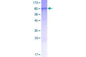 Image no. 1 for Mex-3 Homolog C (C. Elegans) (MEX3C) (AA 1-464) protein (GST tag) (ABIN1310776)