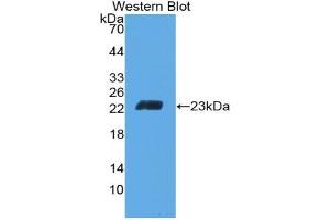 Detection of Recombinant CD6, Mouse using Polyclonal Antibody to Cluster Of Differentiation 6 (CD6) (CD6 anticorps  (AA 30-204))