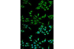 Immunofluorescence analysis of HeLa cell using MSH2 antibody.