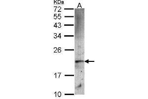 WB Image Sample (30 ug of whole cell lysate) A: A549 12% SDS PAGE antibody diluted at 1:1000 (FTH1 anticorps  (Center))