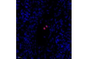 Immunofluorescence of paraffin embedded rat ovary using PTPN2 (ABIN7075295) at dilution of 1:500 (400x lens)
