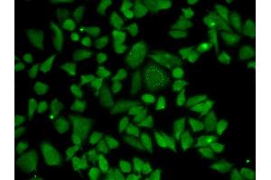 Immunofluorescence analysis of A549 cell using ALDH2 antibody. (ALDH2 anticorps)