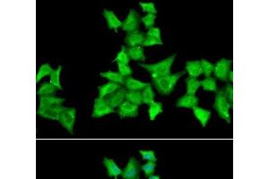 Immunofluorescence analysis of A549 cells using HAPLN1 Polyclonal Antibody (HAPLN1 anticorps)
