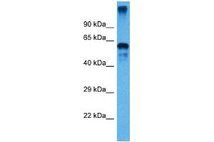 Host:  Mouse  Target Name:  P4HB  Sample Tissue:  Mouse Small Intestine  Antibody Dilution:  1ug/ml (P4HB anticorps  (C-Term))