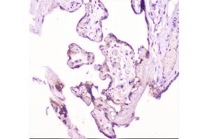 IHC analysis of TANK using anti-TANK antibody (ABIN6719508). (TANK anticorps)