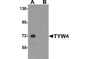 Western blot analysis of TYW4 in rat brain tissue lysate with TYW4 antibody at 1 µg/mL in (A) the absence and (B) the presence of blocking peptide.