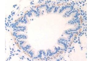 Detection of cTnI in Rat Lung Tissue using Polyclonal Antibody to Cardiac Troponin I (cTnI)