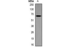 Western blot analysis of MT-ND5 expression in mouse brain (A) whole cell lysates. (MT-ND5 anticorps)