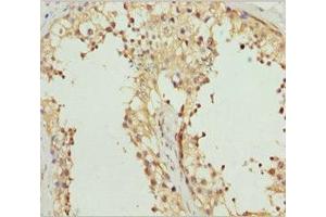 Immunohistochemistry of paraffin-embedded human? (Receptor Accessory Protein 1 anticorps  (AA 101-201))