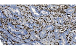 IHC analysis of Coronin 1a/TACO/CORO1A using anti-Coronin 1a/TACO/CORO1A antibody (ABIN7600292).