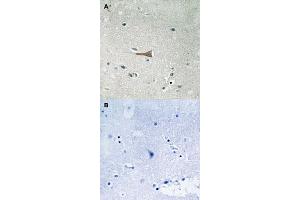 Immunohistochemical staining of human brain tissue by DDR1 (phospho Y513) polyclonal antibody  without blocking peptide (A) or preincubated with blocking peptide (B) under 1:50-1:100 dilution. (DDR1 anticorps  (pTyr513))