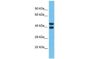 Western Blotting (WB) image for anti-Olfactory Receptor, Family 4, Subfamily Q, Member 3 (OR4Q3) (C-Term) antibody (ABIN2791740) (OR4Q3 anticorps  (C-Term))