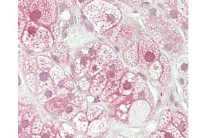 Formalin-fixed and paraffin-embedded H.