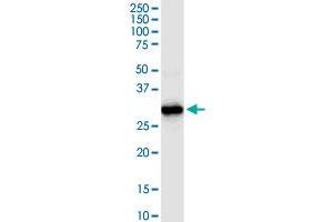 HADH MaxPab rabbit polyclonal antibody. (HADH anticorps  (AA 1-314))