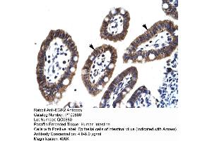 Human Intestine (EGR2 anticorps  (C-Term))