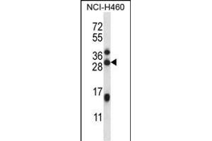 C17orf95 Antibody (C-term) (ABIN6244181 and ABIN6577333) western blot analysis in NCI- cell line lysates (35 μg/lane). (Methyltransferase Like 23 (METTL23) (AA 138-166), (C-Term) anticorps)