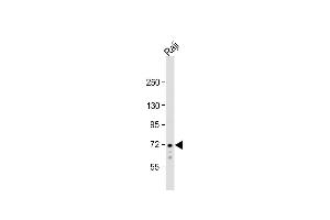 Anti-SYK Antibody  at 1:1000 dilution + Raji whole cell lysate Lysates/proteins at 20 μg per lane.